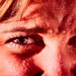 Диагностическая дилемма: женщина начала потеть кровью с лица и рук