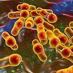 Редкий случай бактериемии, вызванной пробиотиком: история 70-летнего пациента из Японии