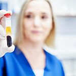 Отпечатки пальцев рака обнаружены после того, как ученые облучили образцы крови импульсами инфракрасного света