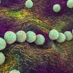 Смертельная угроза вульвы: почему гинекологи должны знать о «плотоядных» инфекциях