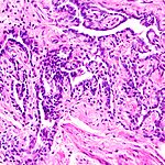 Rete ovarii: забытый ключ к женской фертильности?