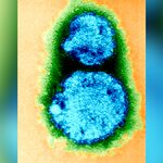 Что такое хантавирус? Редкое, но смертельно опасное респираторное заболевание, распространяемое грызунами