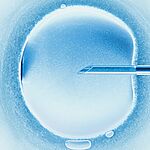 Революция в репродуктивных технологиях: первый в мире ребенок, зачатый с помощью роботизированного ЭКО