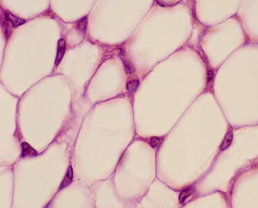 Революция в тарелке и за её пределами: почему учёные решили подружиться с жиром